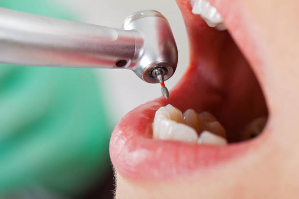 Best Tooth Infection Emergency Dentist  in El Dorado, AR